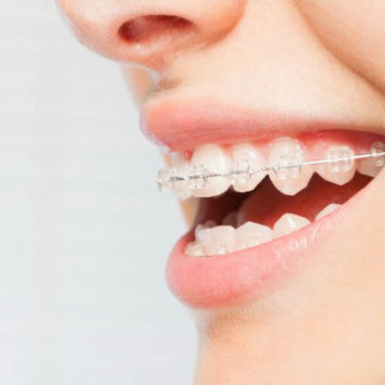 Orthodontics