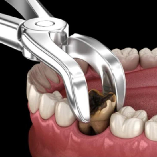 oral surgery
